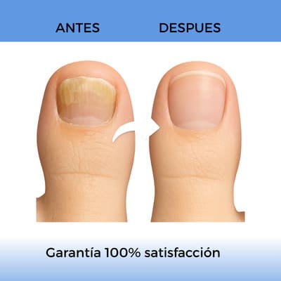 ¡LLEVA 3 Y PAGA 2 SOLO POR HOY!